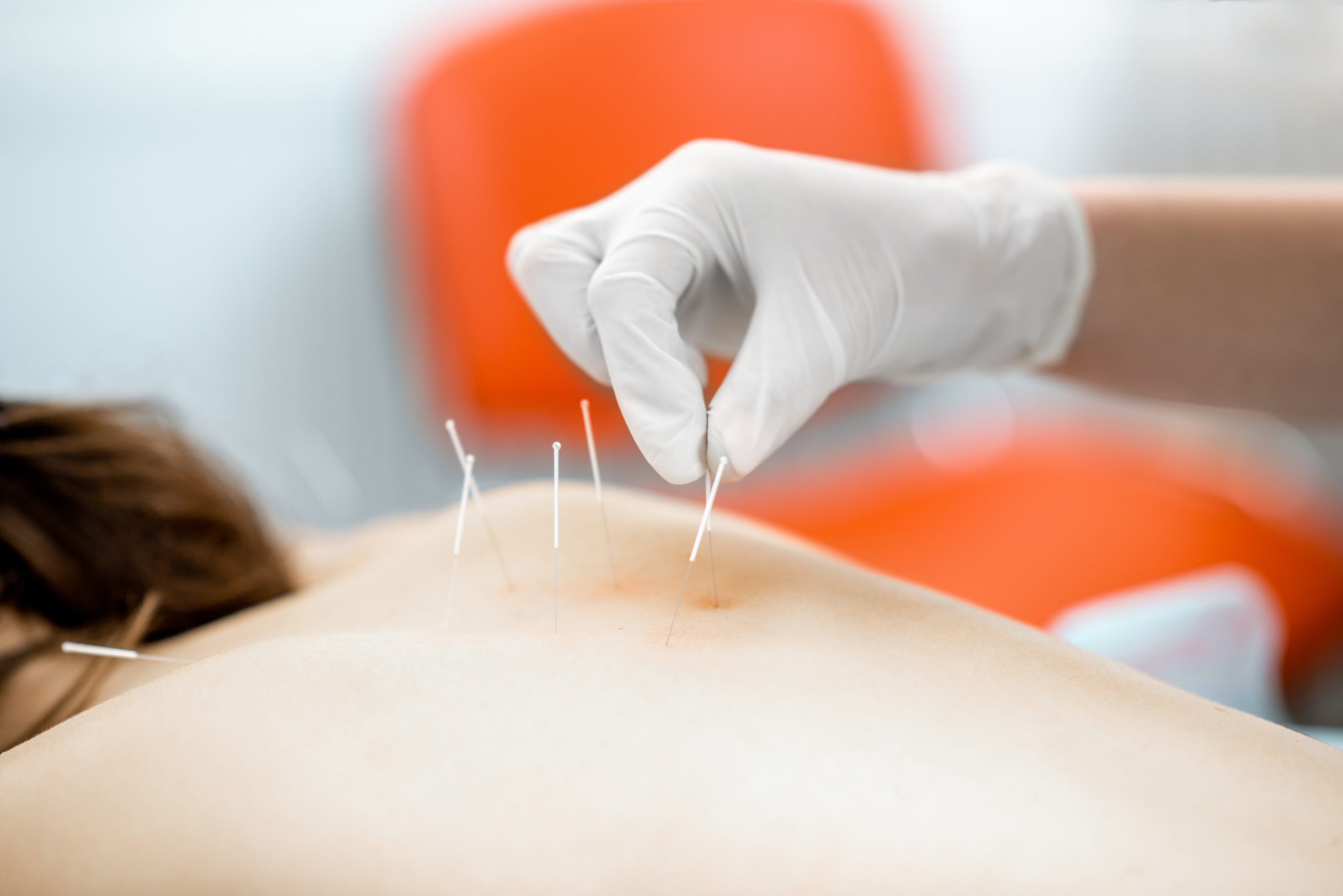 acupuncture medical treatment 2026 01 08 23 35 33 utc